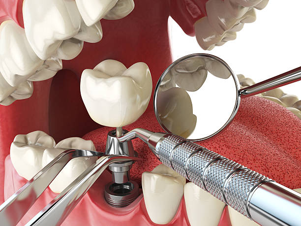 Best Urgent Tooth Repair  in Torrington, WY